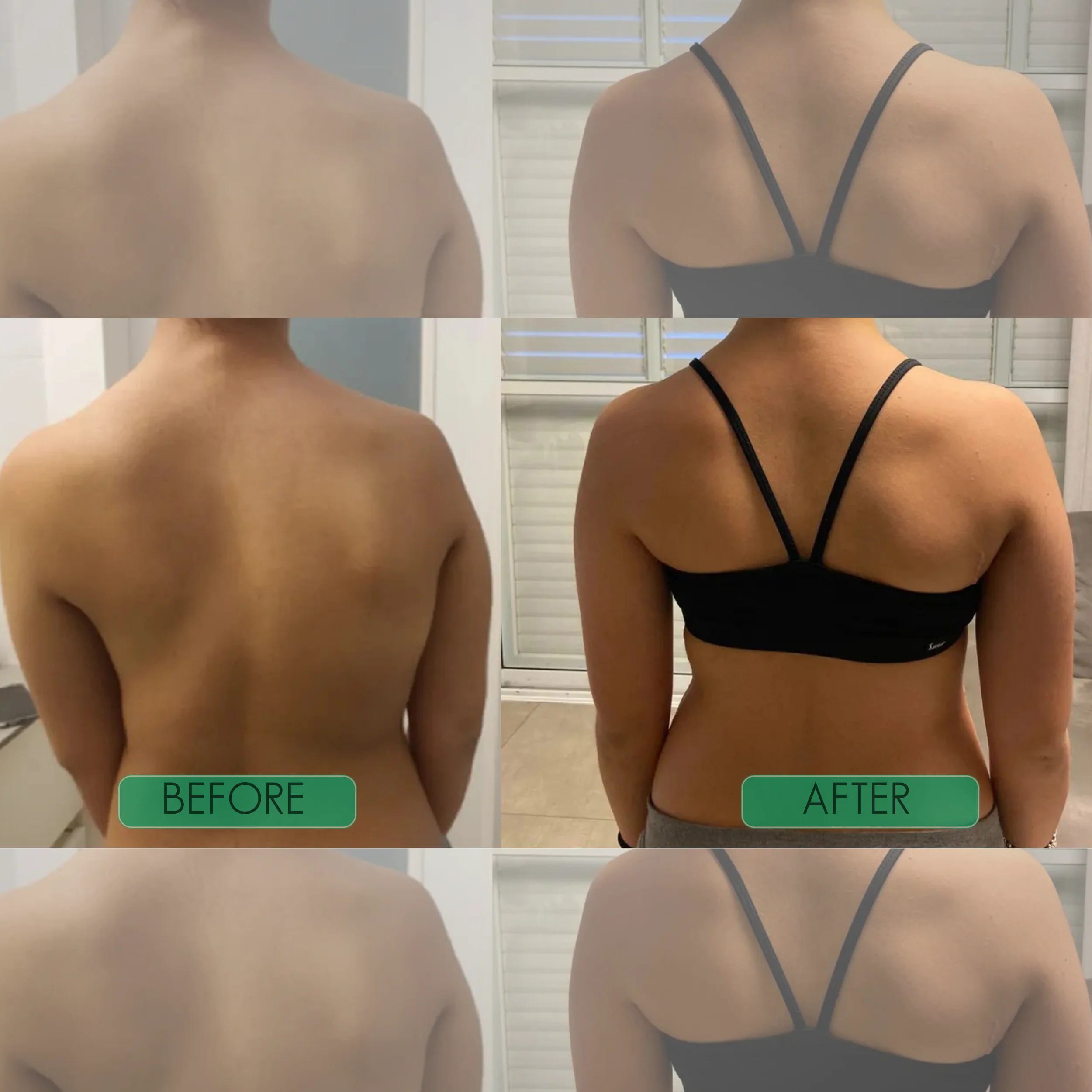 Instant Posture Corrector - Image 3