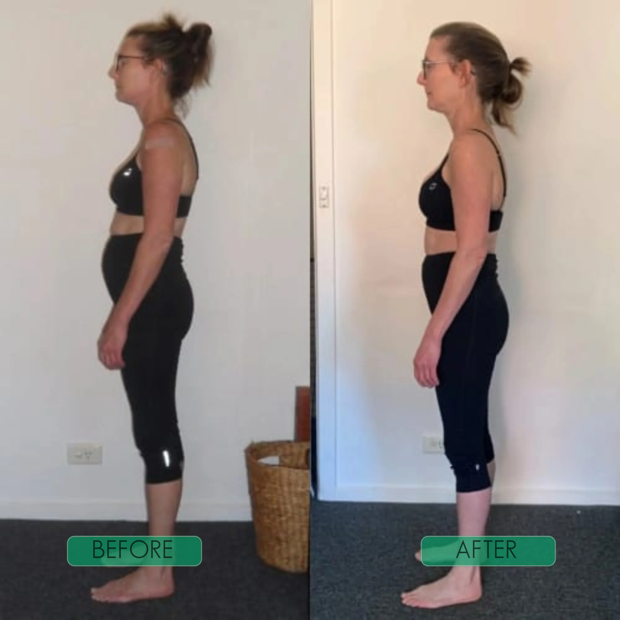 Instant Posture Corrector - Image 6