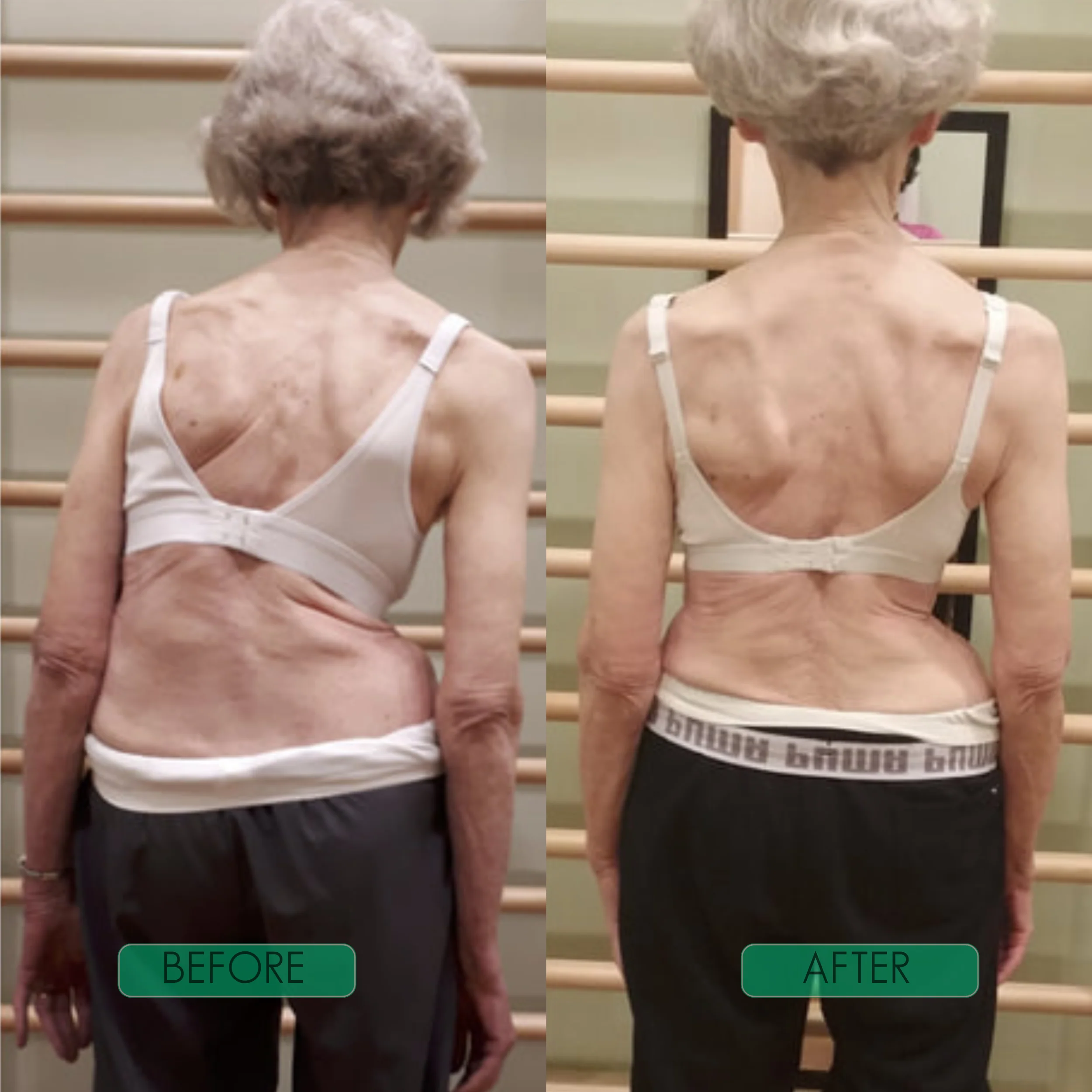 Spinal Re-Adaptation System - Image 3