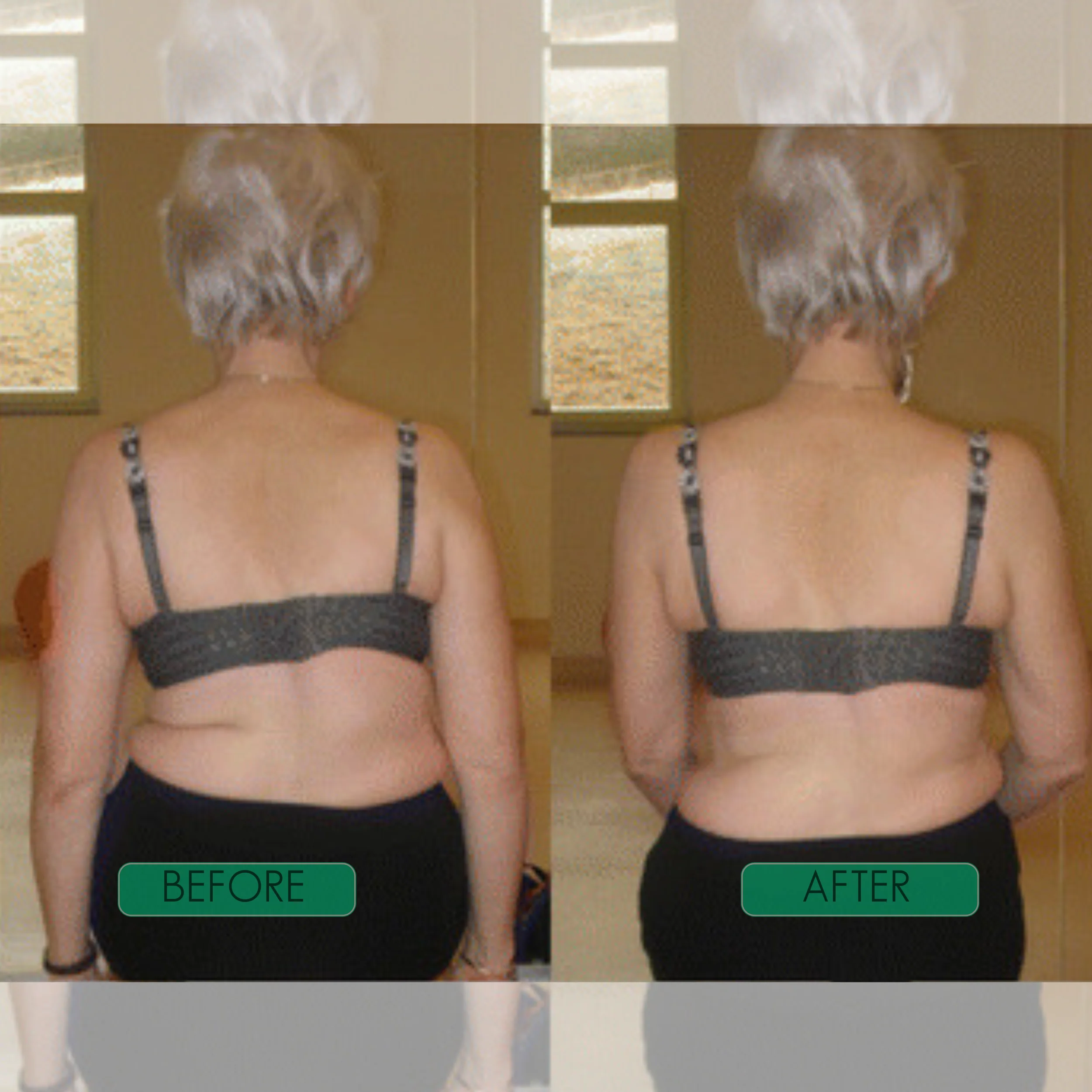 Spinal Re-Adaptation System - Image 4