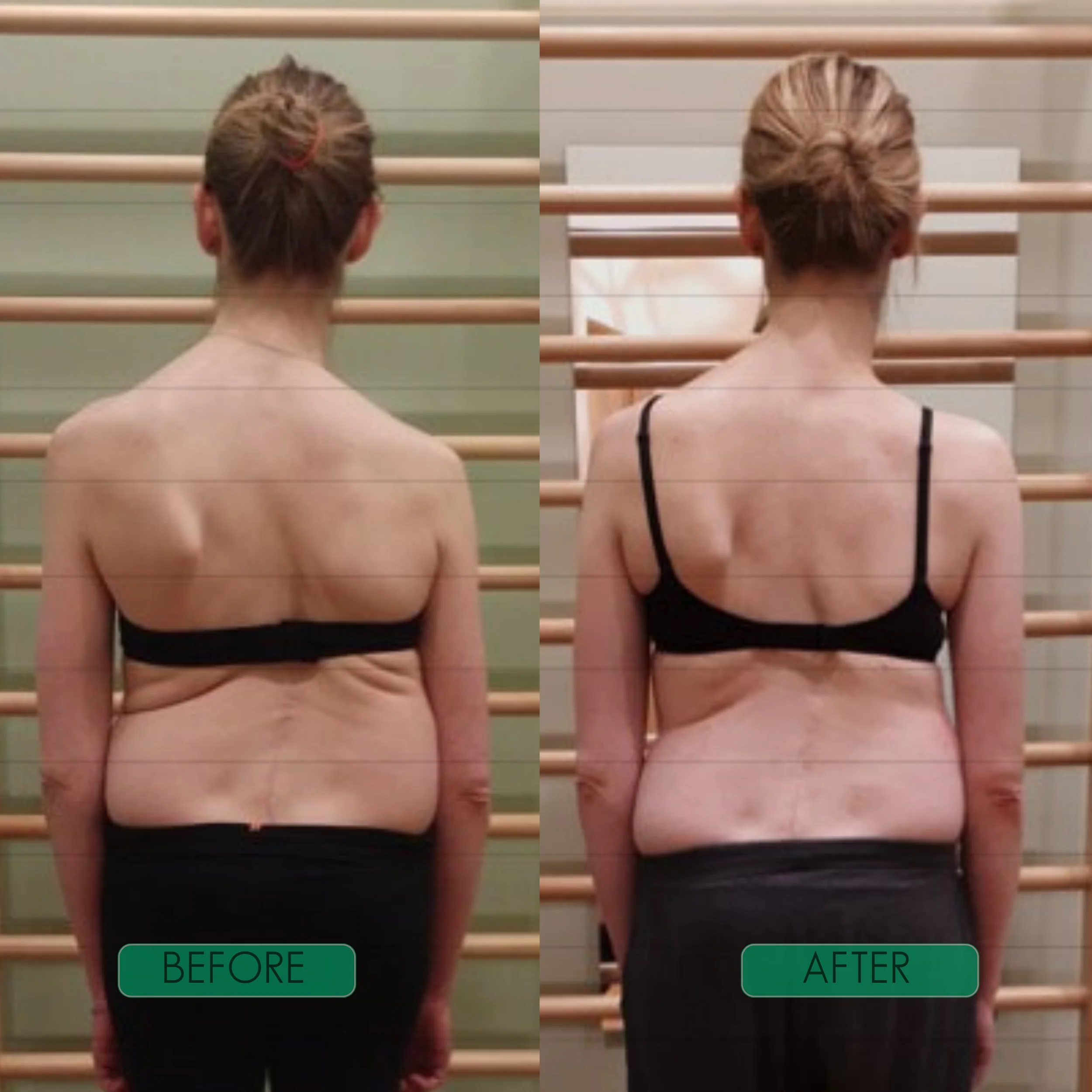 Spinal Re-Adaptation System - Image 5